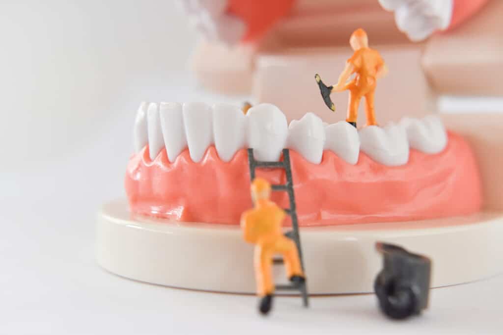Smiling patient showing teeth after treatment by a mini implant dentist in Louisville.