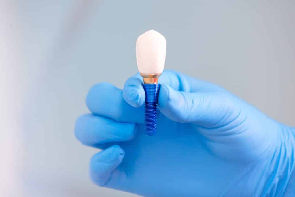 Mini Dental Louisville